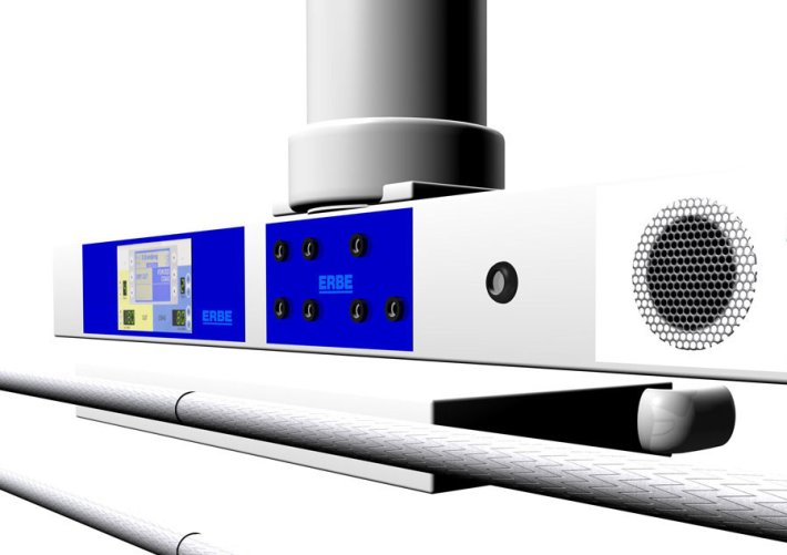 CCI mit Expimental-OP für Ondal
